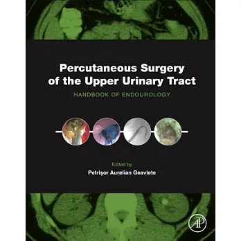Percutaneous Surgery of the Upper Urinary Tract: Handbook of Endourology