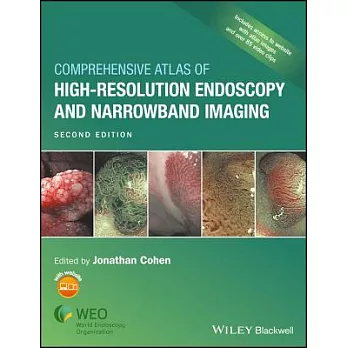Comprehensive Atlas of High-Resolution Endoscopy and Narrowband Imaging