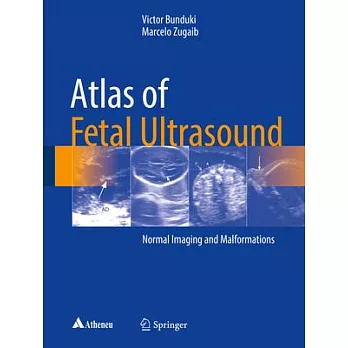 Atlas De Ultrassom Fetal Normal E Malformações: Normal Imaging and Malformations