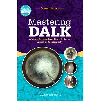 Mastering Dalk: A Video Textbook on Deep Anterior Lamellar Keratoplasty