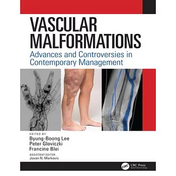 Vascular Malformations: Advances and Controversies in Contemporary Management