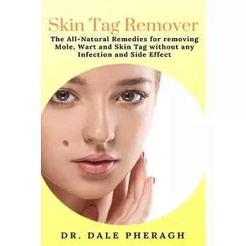 Skin Tag Remover: The All-Natural Remedies for removing Mole, Wart and Skin Tag without any Infection and Side Effect