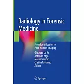 Radiology in Forensic Medicine: From Identification to Post-Mortem Imaging