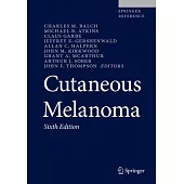 Cutaneous Melanoma [With eBook]