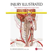 Injury Illustrated: How Medical Images Win Legal Cases