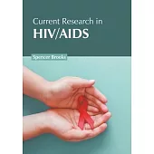 Current Research in Hiv/AIDS