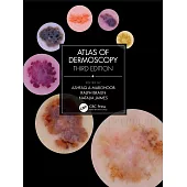 Atlas of Dermoscopy: Third Edition