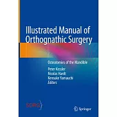 Illustrated Manual of Orthognathic Surgery: Pre-Surgical Steps and Osteotomies of the Mandible