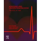 Assessing and Understanding Ecgs: The ECG 10+ Tool