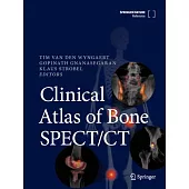 Clinical Atlas of Bone Spect/CT
