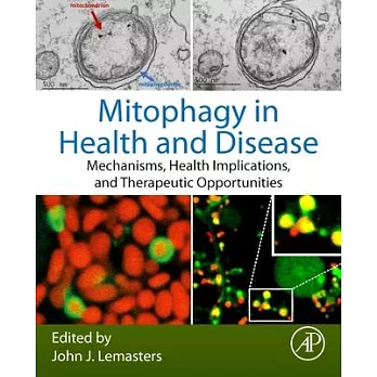 Mitophagy in Health and Disease: Mechanisms, Health Implications, and Therapeutic Opportunities