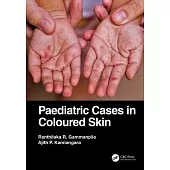 Paediatric Cases in Coloured Skin