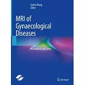 MRI of Gynaecological Diseases: Illustrations and Cases