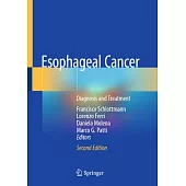Esophageal Cancer: Diagnosis and Treatment