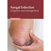 Fungal Infection: Diagnosis and Management