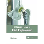 A Clinician’s Guide to Joint Replacement