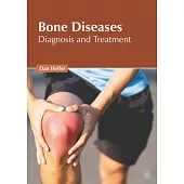 Bone Diseases: Diagnosis and Treatment