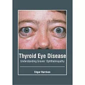 Thyroid Eye Disease: Understanding Graves’ Ophthalmopathy