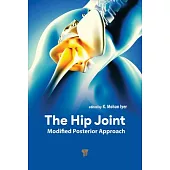 The Hip Joint: Modified Posterior Approach