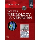 Volpe’s Neurology of the Newborn