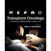 Transplant Oncology: A Frontier in Multidisciplinary Cancer Care