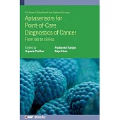 Aptasensors for Point-Of-Care Diagnostics of Cancer: From Lab to Clinics