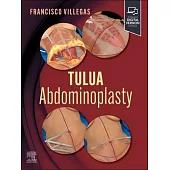 Tulua Abdominoplasty: Transverse Plication Technique