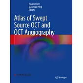 Atlas of Swept Source Oct and Oct Angiography