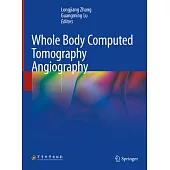 Whole Body Computed Tomography Angiography
