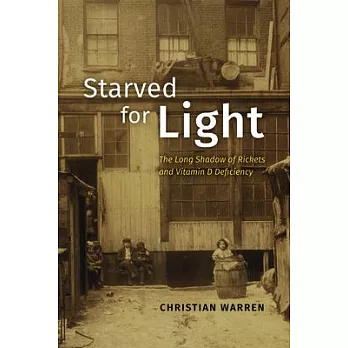 Starved for Light: The Long Shadow of Rickets and Vitamin D Deficiency