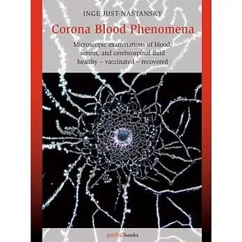 Corona Blood Phenomena: Microscopic Examinations of Blood, Serum, and Cerebrospinal Fluid: Healthy - Vaccinated - Recovered