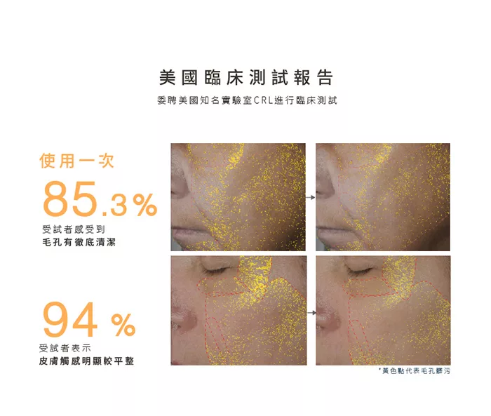 Nion Beauty - Opus Luxe 雙效負離子按摩潔面儀/洗臉機-白色