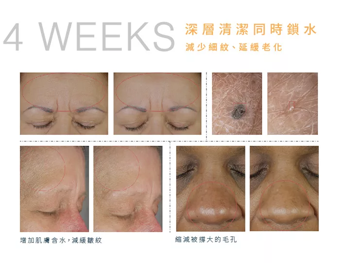 Nion Beauty - Opus Luxe 雙效負離子按摩潔面儀/洗臉機-白色